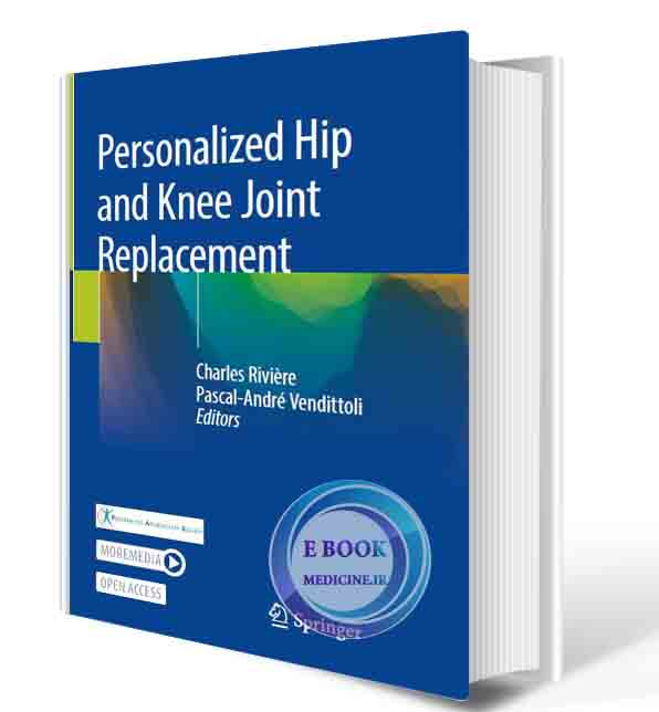 دانلود کتابPersonalized Hip and Knee Joint Replacement 1st ed. 2020 (L PDF)